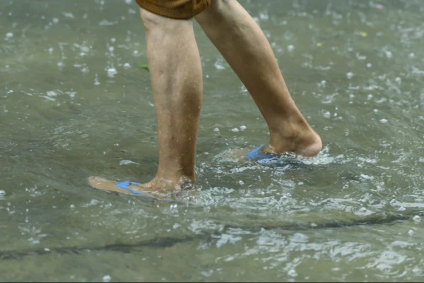 ¿Cómo prevenir la leptospirosis?